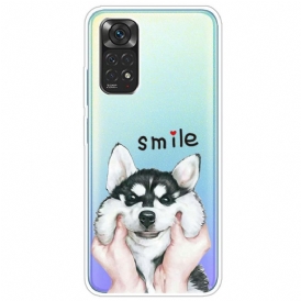 Skal För Xiaomi Redmi Note 11 / 11S Smile Dog