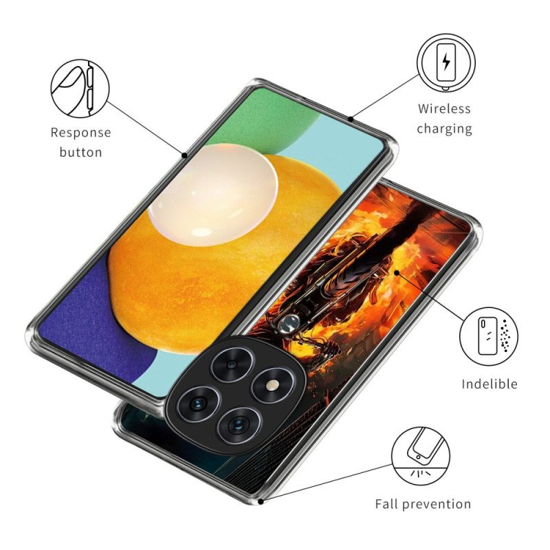 Skal Xiaomi Redmi Note 14 Pro 4g Eldriddare